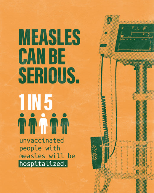 Measles can be serious. 1 in 5 unvaccinated people with measles will be hospitalized