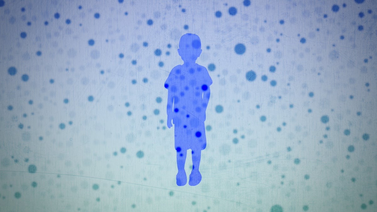 The U.S. could lose its measles elimination status. Here’s what that mean